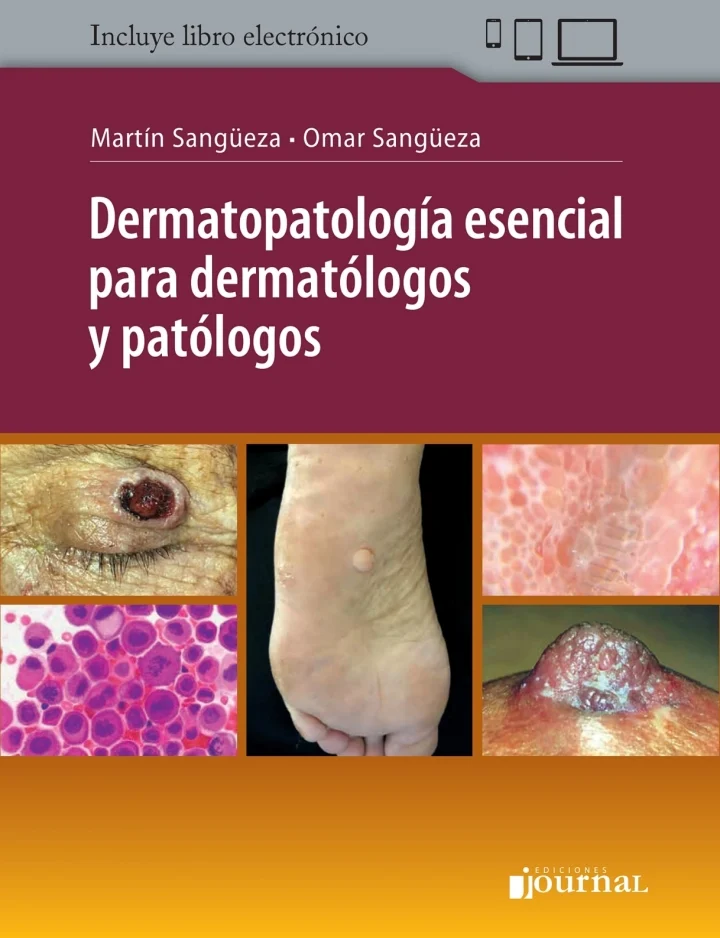 Dermatopatología esencial para dermatólogos y patólogos (Original PDF from Publisher) Dermatopatología esencial para dermatólogos y patólogos (Original PDF from Publisher)