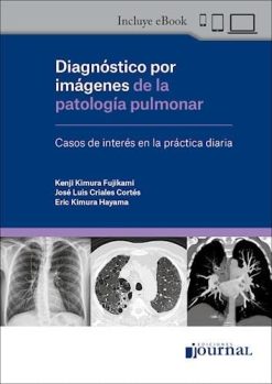 Diagnóstico por Imágenes de la Patología Pulmonar. Casos de Interés en la Práctica Diaria (Original PDF from Publisher)
