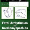 Fetal Arrhythmias and Cardiomyopathies – simplified (AZW3 + EPUB + Converted PDF)