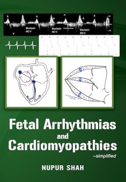 Fetal Arrhythmias and Cardiomyopathies – simplified (AZW3 + EPUB + Converted PDF)