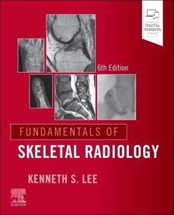 Fundamentals of Skeletal Radiology, 6th edition (True PDF)