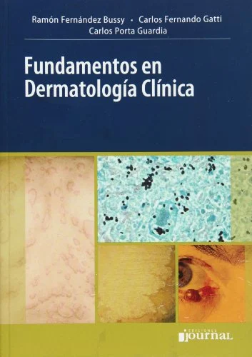 Fundamentos en Dermatologia Clinica (Spanish Edition) (Original PDF from Publisher) Fundamentos en Dermatologia Clinica (Spanish Edition) (Original PDF from Publisher)