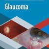 Glaucoma (Spanish Edition) (Original PDF from Publisher)