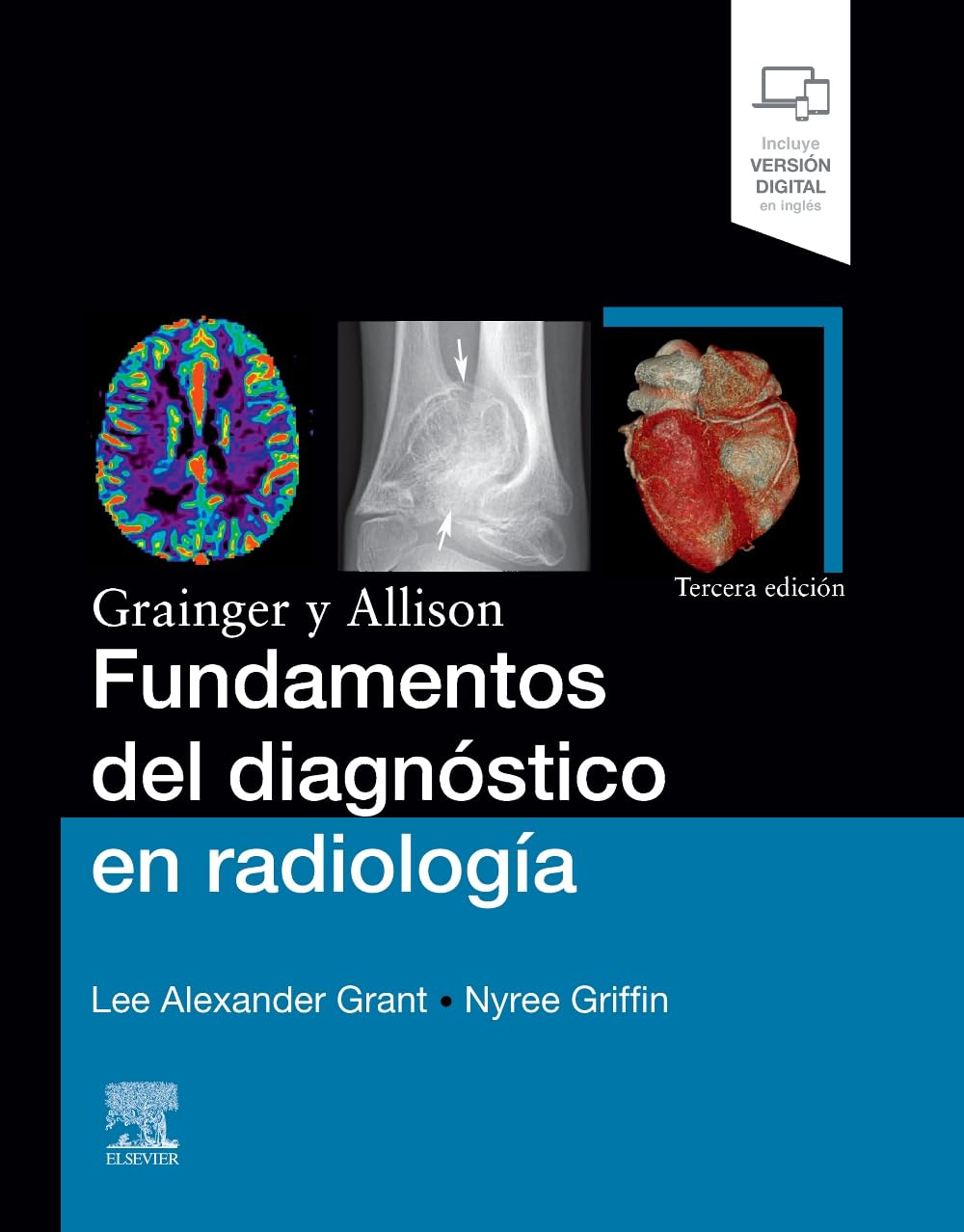 Grainger y Allison. Fundamentos del diagnóstico en radiología, 3rd Edition (Original PDF from Publisher) Grainger y Allison. Fundamentos del diagnóstico en radiología, 3rd Edition (Original PDF from Publisher)