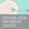 Houston Methodist Advanced Interventional Breast Imaging