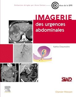 Imagerie des urgences abdominales (True PDF)