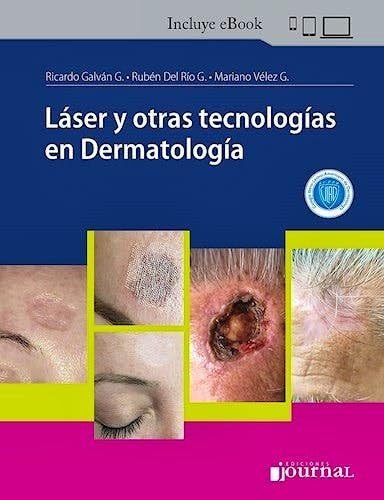 Láser y otras tecnologías en Dermatología (Original PDF from Publisher) Láser y otras tecnologías en Dermatología (Original PDF from Publisher)