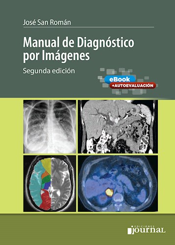 Manual de Diagnóstico por Imágenes. 2° edición (Original PDF from Publisher) Manual de Diagnóstico por Imágenes