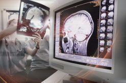 Penn Radiology Comprehensive Neuroradiology: Imaging Ideals 2022