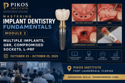 Pikos Institute Mastering Implant Dentistry Fundamentals Module 2 Multiple Implants
