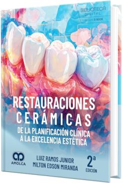 Restauraciones cerámicas. De la planificación clínica a la excelencia estética, 2ª edición