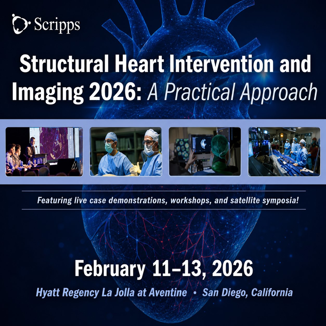 Scripps 15th Annual Structural Heart Intervention and Imaging 2026 Scripps 15th Annual Structural Heart Intervention and Imaging 2026