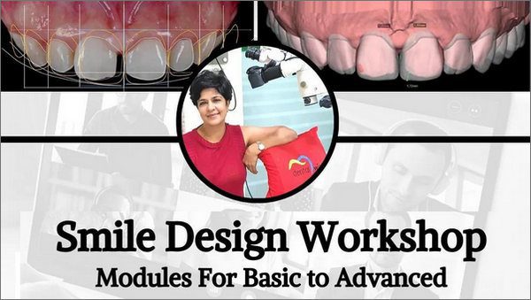 Smile Design Workshop, Modules for Basic to Advanced Smile Design Workshop, Modules for Basic to Advanced