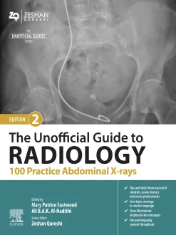 The Unofficial Guide to Radiology: 100 Practice Abdominal X-rays, 2nd Edition (EPUB)