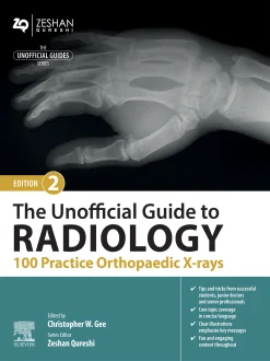 The Unofficial Guide to Radiology: 100 Practice Orthopaedic X-rays, 2nd Edition (EPUB)