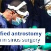 Osteocom - Simplified Antrostomy Design in Sinus Surgery - Tiziano Testori Osteocom - Simplified Antrostomy Design in Sinus Surgery - Tiziano Testori