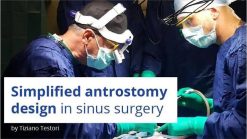 Osteocom - Simplified Antrostomy Design in Sinus Surgery - Tiziano Testori