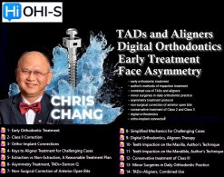 OHI-S TADs and Aligners, Digital Orthodontics, Early Treatment, Face Asymmetry