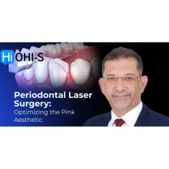 OHIS Laser Periodontology: Optimizing the Pink Aesthetic
