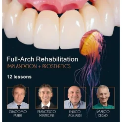 OHI-S Full-Arch Rehabilitation, Implantation and Prosthetics