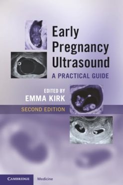 Early Pregnancy Ultrasound, 2nd edition (EPUB)