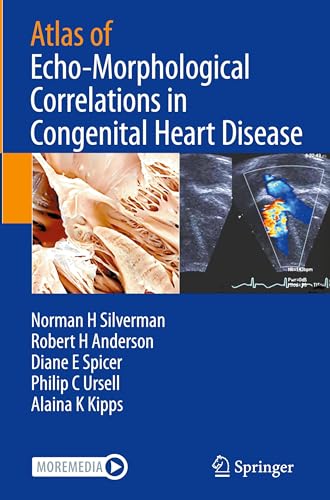 Atlas of Echo-Morphological Correlations in Congenital Heart Disease (Original PDF from Publisher) Atlas of Echo-Morphological Correlations in Congenital Heart Disease (Original PDF from Publisher)