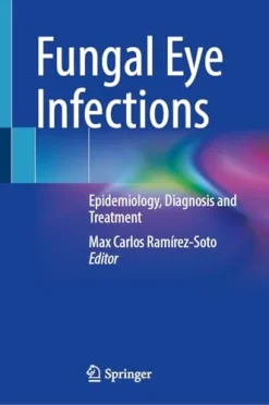 Fungal Eye Infections: Epidemiology, Diagnosis and Treatment (EPUB)