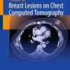 Atlas of Breast Lesions on Chest Computed Tomography (Original PDF from Publisher) Atlas of Breast Lesions on Chest Computed Tomography (Original PDF from Publisher)