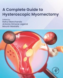 A Complete Guide to Hysteroscopic Myomectomy (Original PDF from Publisher)