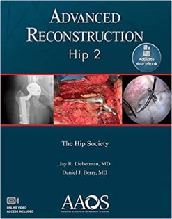 Advanced Reconstruction Hip 2 (Original PDF from Publisher)