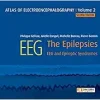 Atlas of electroencephalography:The Epilepsies. EEG and epileptic syndromes, Volume 2 (Original PDF from Publisher) Atlas of electroencephalography