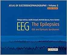 Atlas of electroencephalography:The Epilepsies. EEG and epileptic syndromes, Volume 2 (Original PDF from Publisher) Atlas of electroencephalography