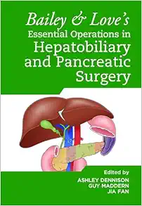 Bailey & Love’s Essential Operations in Hepatobiliary and Pancreatic Surgery (Original PDF from Publisher)