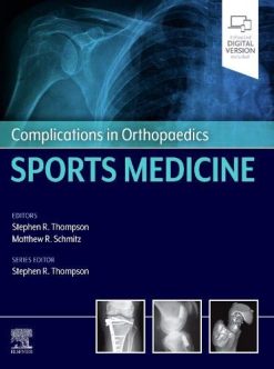 Complications in Orthopaedics: Sports Medicine (Original PDF from Publisher)