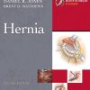 Master Techniques in Surgery: Hernia, 2nd Edition (Videos only) Master Techniques in Surgery: Hernia, 2nd Edition (Videos only)