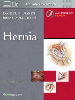 Master Techniques in Surgery: Hernia, 2nd Edition (Videos only)