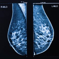 Oakstone UCSF Breast Imaging 2026