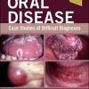 Oral Disease: Case Studies of Difficult Diagnoses (EPUB) Oral Disease: Case Studies of Difficult Diagnoses (EPUB)