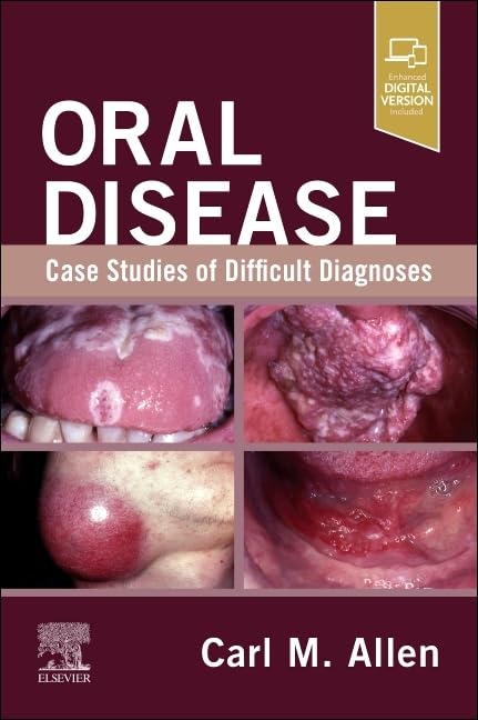 Oral Disease: Case Studies of Difficult Diagnoses (EPUB) Oral Disease: Case Studies of Difficult Diagnoses (EPUB)