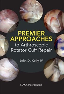 Premier Approaches to Arthroscopic Rotator Cuff Repair (Original PDF from Publisher)