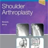 Shoulder Arthroplasty, 2e (Original PDF from Publisher) Shoulder Arthroplasty, 2e (Original PDF from Publisher)