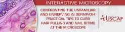 USCAP Confronting the Unfamiliar and Unnerving in Dermpath Practical Tips to Curb Hair Pulling and Nail Biting at the Microscope 2026