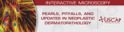 USCAP Pearls, Pitfalls, and Updates in Neoplastic Dermatopathology 2025