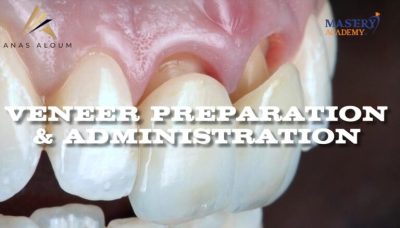Mastery Academy Veneer Preparation and Administration – Anas Aloum Mastery Academy Veneer Preparation and Administration – Anas Aloum