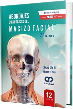Abordajes Quirúrgicos del Macizo Facial, 3a edición (Scanned PDF)