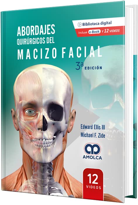 Abordajes Quirúrgicos del Macizo Facial, 3a edición (Scanned PDF) Abordajes Quirúrgicos del Macizo Facial, 3a edición (Scanned PDF)