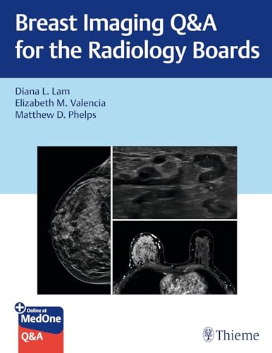 Breast Imaging Q&A for the Radiology Boards (Original PDF from Publisher) Breast Imaging Q&A for the Radiology Boards (Original PDF from Publisher)