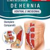 El Arte de la Cirugía de Hernia, Ventral e Incisional (Spanish Edition) (Scanned PDF) El Arte de la Cirugía de Hernia, Ventral e Incisional (Spanish Edition) (Scanned PDF)