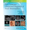 First Trimester Ultrasound Diagnosis of Fetal Abnormalities, 2nd edition (EPUB) First Trimester Ultrasound Diagnosis of Fetal Abnormalities, 2nd edition (EPUB)