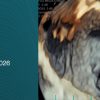 Harvard Boston 3D Echo Workshop 2026 Harvard Boston 3D Echo Workshop 2026